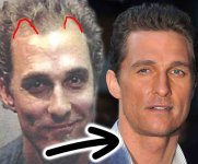 Matthew-McConaughey-Hair-Loss-Secrets-Revealed.jpg