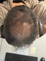 WhatsApp Image 2025 06 17 at 182010 1 WhatsApp Image 2025 06 17 at 182010 1