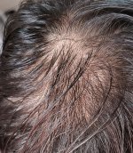 1000003264_edited (3).jpeg