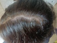 settembre 25 - forfora.jpg