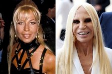 donatella-versace-before-and-after-plastic-surgery-v0-6cyzbFORR35mofMZYCiVpd_LsQchz-8tak43te1W...jpg