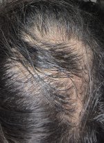 1000052407_edited (2).jpeg