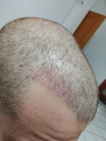 Immagine WhatsApp 2025-11-29 ore 18.11.42_96f7ebb0.jpg