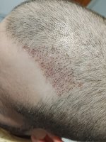 Immagine WhatsApp 2025-11-29 ore 18.11.42_f9e8b963.jpg