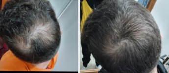 1000142921 1000142921