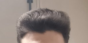 1000142926 1000142926