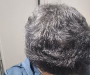 1000142927 1000142927