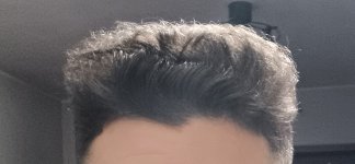 1000144108 1000144108