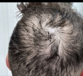 1000144109 1000144109