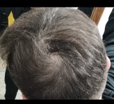 1000144111 1000144111