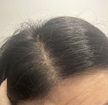 riga senza flash si vedono le pellicine.jpg