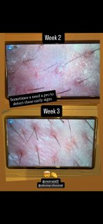 F0db6512 2c05 420e 8e00 edacacdc8256