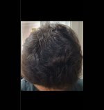 1000165189 1000165189