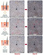 pelage-pp405-new-hair-growth-from-inactive-follicular-units-v0-4ghojtg7nvrg1.jpg