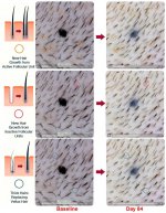 pelage-pp405-new-hair-growth-from-inactive-follicular-units-v0-upc0m0h7nvrg1.jpg