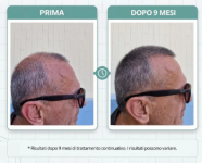 Immagine 2026-04-18 101743.png