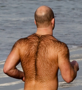 Uno studio preliminare ha verificato che finasteride sarebbe più efficace sui calvi che sono anche villosi (pelosi)