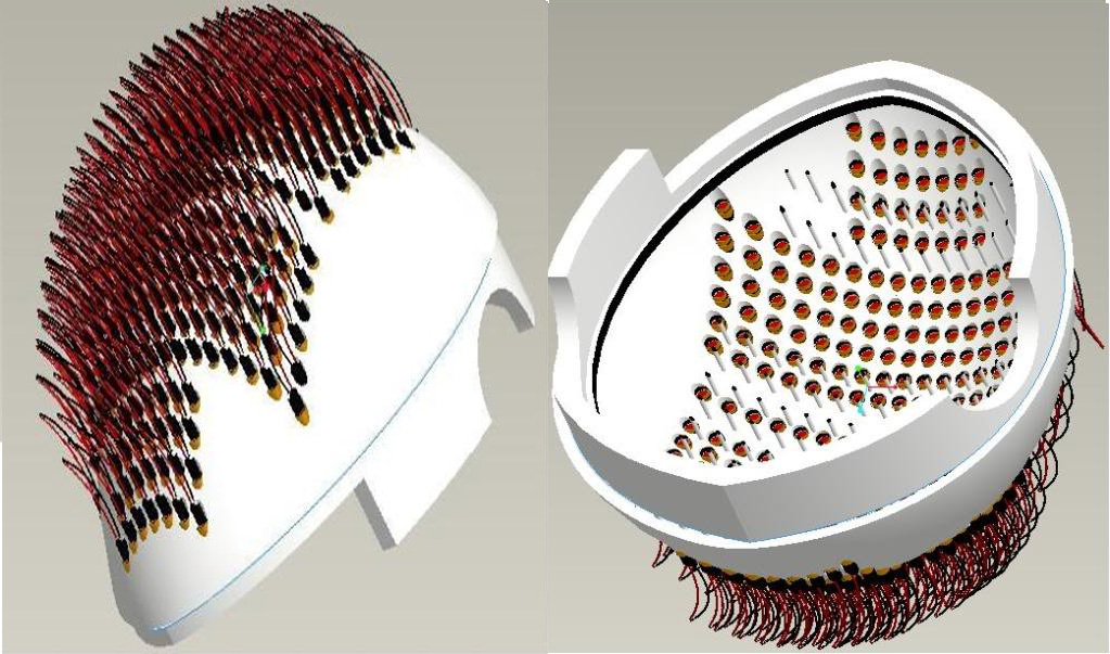 Un casco con diodi laser per la terapia LLLT delle alopecie