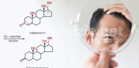 testosterone