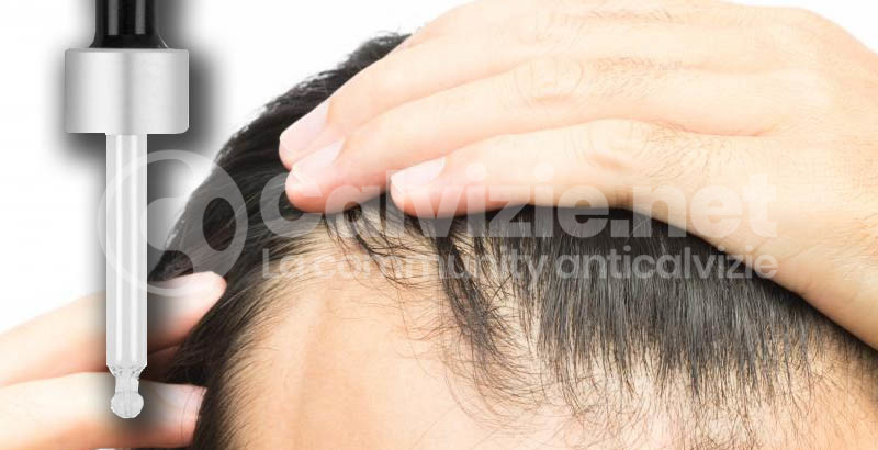 Rimedi contro la calvizie: le microfibre per capelli - Info calvizie
