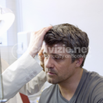 novità cura calvizie