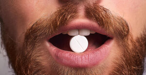 Minoxidil e finasteride orali