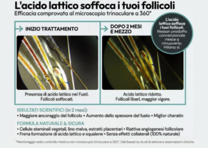 cellule staminali vegetali