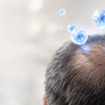 Esosomi per i capelli